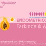 Endometriozis Çikolata Kisti Nedir