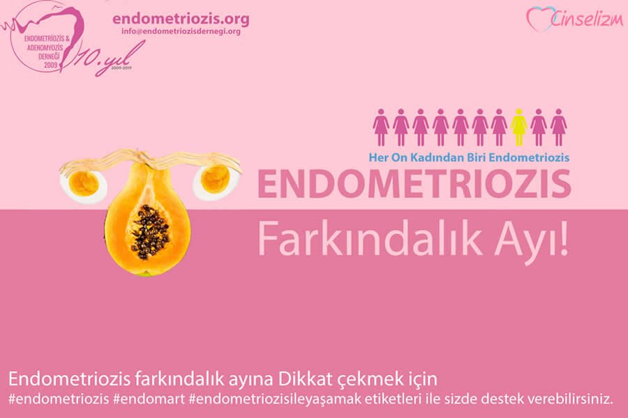 Endometriozis Çikolata Kisti Nedir