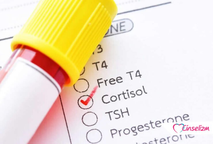 Stres Hormonu Kortizol Nedir
